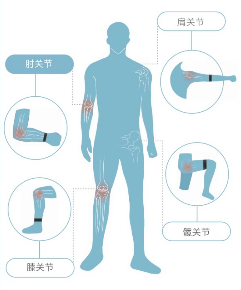 关节监测仪